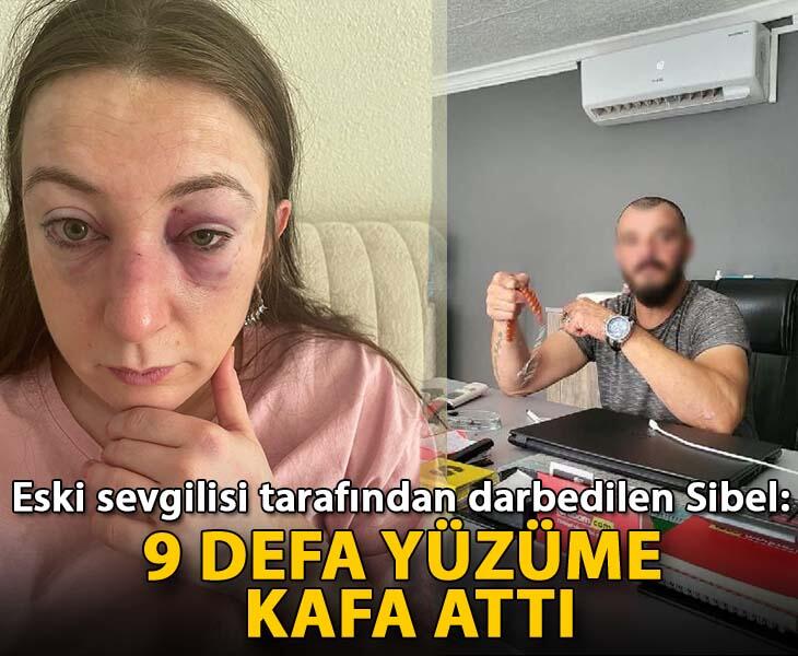 Eski sevgilisi tarafından darbedilen Sibel 9 defa yüzüme kafa attı