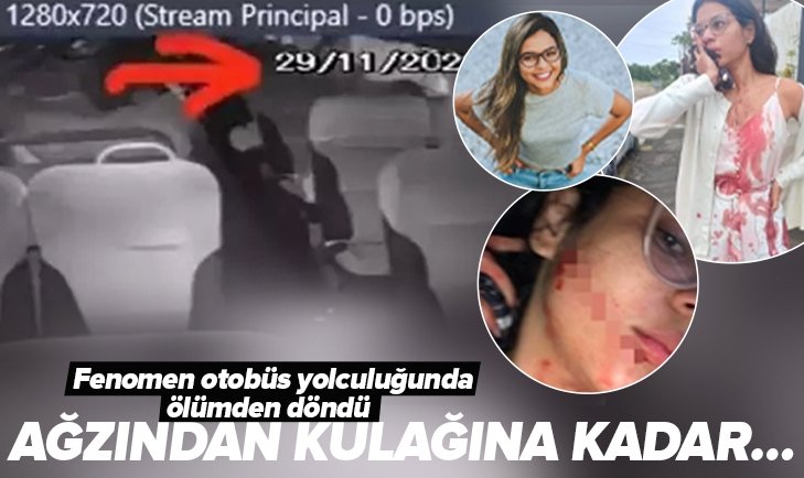 Sosyal medya fenomenine otobüs yolculuğu eziyet oldu Sebepsiz yere suratına KESİK ATILDI Ağzından kulağına kadar dikiş atıldı