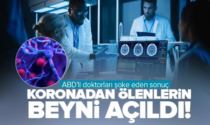 ABD de koronadan ölenlerin beyni açıldı Sonuçlar doktorları bile şoke etti