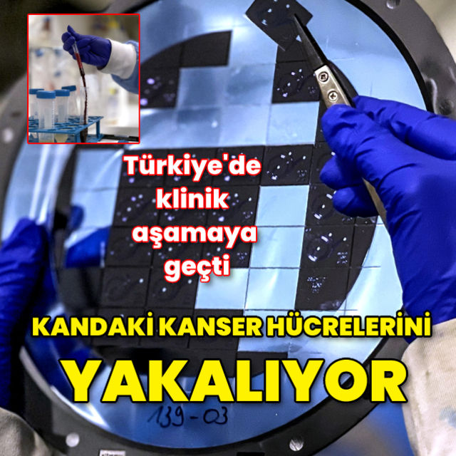 Kanda dolaşan kanser hücrelerini yakalayan akıllı çip yöntemi Türkiye de klinik aşamaya geçti